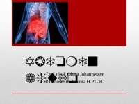 Abdomen Agudo - Cirugia