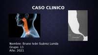 ACALASIA - CASO CLINICO