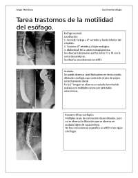 Trastornos de la motilidad del esofago