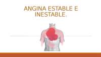 Angina Estable e Inestable: Etiología, Signos y Síntomas, Diagnóstico y Tratamiento