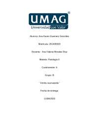Fisiopatología y tratamiento de artritis reumatoide