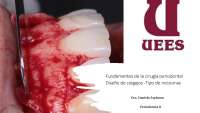 TRATADO DE CIRUGIA PERIODONTAL BASADO EN EVIDENCIA ACTUAL