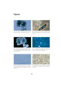 Análisis microscópico de la orina: identificación de leucocitos, eritrocitos y cilindros