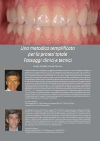 Montaggio dei denti in protesi totale
