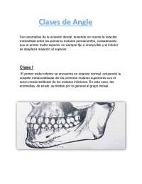 Clasificación y patologías de la oclusión dental y la articulación temporomandibular