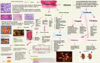 Mapa mental de pielonefritis