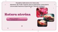 Rotura uterina completa