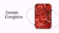 Anemia Ferropriva: Diagnóstico e Tratamento