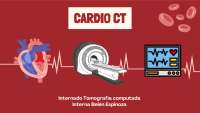 Cardio CT: Una Guía Básica para la Evaluación Cardíaca
