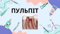 Патанатомія гінгівіту
