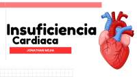 Insuficiencia Cardíaca: Diagnóstico, Fisiopatología y Tratamiento Actualizado