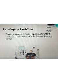 Overview of a Hemodialysis Machine