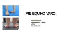 PIE EQUINOVARO PRESENTACIÓN