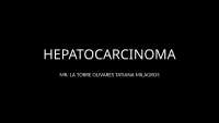 HEPATOCARCINOMA MANEJO