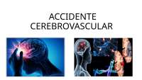 accidente cerebrovascular