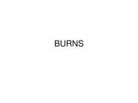BURNS.pptxBURNS.pptx