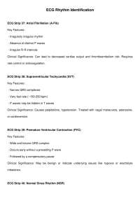 EKG paperwork and information