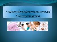 INTERPRETACION DE EKG