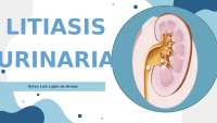 En esta presentación se revisarán los aspectos generales de la litiasis renal, incluyendo