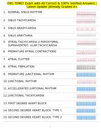 EKG TENET Exam with All Correct & 100% Verified Answers |Latest Update |Already Graded A+