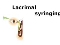Lacrimal syringing for patent lacrimal duct