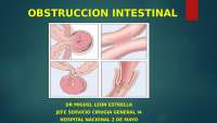 Enfermedad intestinal inflamatorio