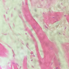 oxitocina.estresada
