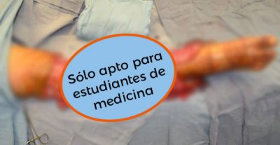 Lesiones de degloving para estudiantes de medicina Lesiones de degloving para estudiantes de medicina