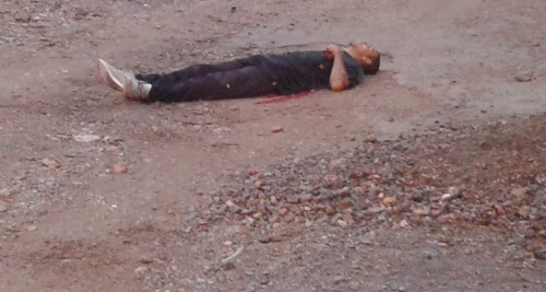 posiciones cadavéricas decúbito dorsal