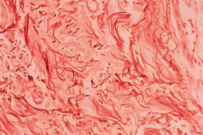 tinciones de histologia orceina